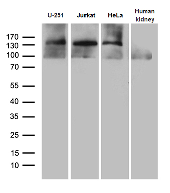 Western blot analysis of extracts (35ug) from 3 different cell lines and human kidney tissue lysate by using anti-SUPT16H monoclonal antibody (1:500)