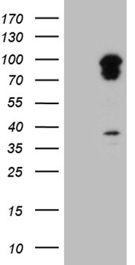 HEK293T cells were transfected with the pCMV6-ENTRY control (Left lane) or pCMV6-ENTRY TRAFD1 (Right lane) cDNA for 48 hrs and lysed