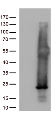 HEK293T cells were transfected with the pCMV6-ENTRY control (Left lane) or pCMV6-ENTRY ASF1B (Right lane) cDNA for 48 hrs and lysed