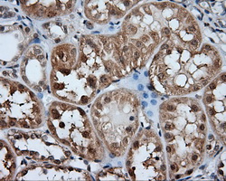 m05215 1 anti hdac10 mouse monoclonal antibody clone id oti8g5 ihc testing 4