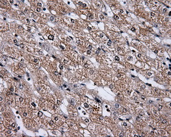 m05215 1 anti hdac10 mouse monoclonal antibody clone id oti8g5 ihc testing 5