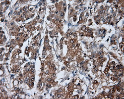 m05215 1 anti hdac10 mouse monoclonal antibody clone id oti8g5 ihc testing 6