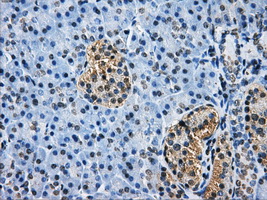 m05215 2 anti hdac10 mouse monoclonal antibody clone id oti7c3 ihc testing 2