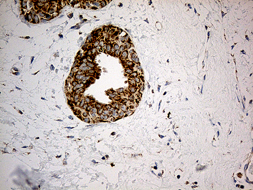 Immunohistochemical staining of paraffin-embedded Human breast tissue within the normal limits using anti-ACAD9 mouse monoclonal antibody