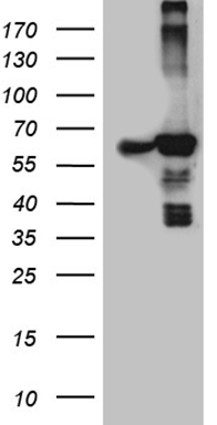 HEK293T cells were transfected with the pCMV6-ENTRY control (Left lane) or pCMV6-ENTRY ACAD9 (Right lane) cDNA for 48 hrs and lysed