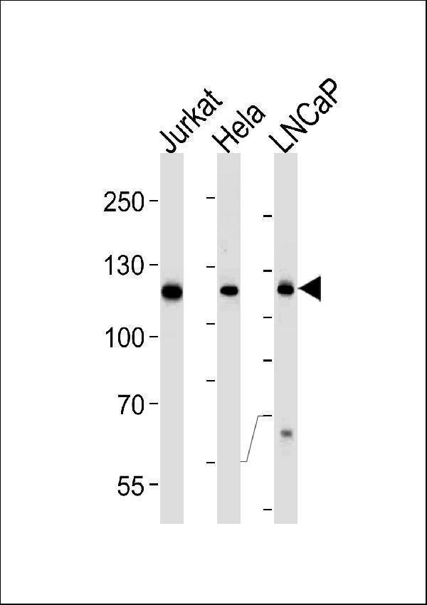 m05225 1 anti usp11 antibody c term r565 wb testing 1