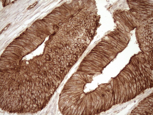 m05231 anti eplin lima1 mouse monoclonal antibody clone id oti1a3 ihc testing 10