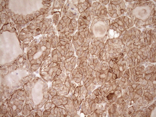m05231 anti eplin lima1 mouse monoclonal antibody clone id oti1a3 ihc testing 3