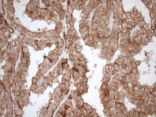 m05231 anti eplin lima1 mouse monoclonal antibody clone id oti1a3 ihc testing 4