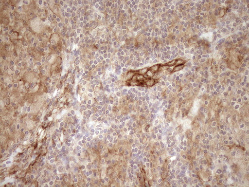 m05231 anti eplin lima1 mouse monoclonal antibody clone id oti1a3 ihc testing 6