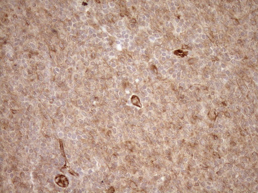 m05231 anti eplin lima1 mouse monoclonal antibody clone id oti1a3 ihc testing 7