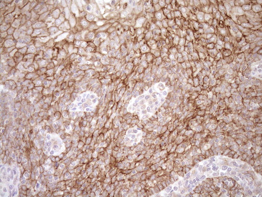m05231 anti eplin lima1 mouse monoclonal antibody clone id oti1a3 ihc testing 8