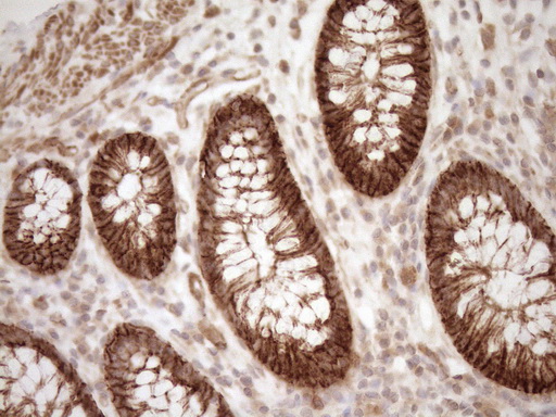 m05231 anti eplin lima1 mouse monoclonal antibody clone id oti1a3 ihc testing 9