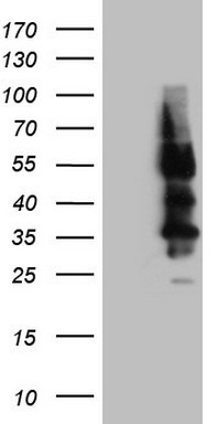 HEK293T cells were transfected with the pCMV6-ENTRY control (Left lane) or pCMV6-ENTRY SSTR4 (Right lane) cDNA for 48 hrs and lysed