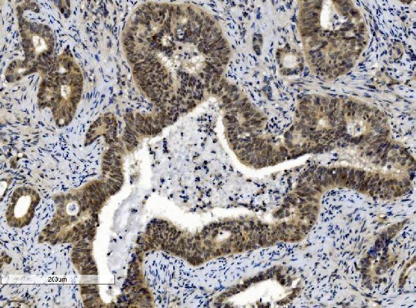  IHC analysis of Cbx8 using anti-Cbx8 antibody (M05234)
