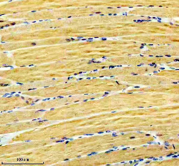 m05235 casq1 primary antibodies ihc testing 2