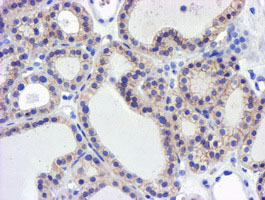 m05239 anti gsto2 mouse monoclonal antibody clone id oti2a12 ihc testing 2