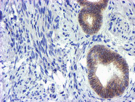 m05239 anti gsto2 mouse monoclonal antibody clone id oti2a12 ihc testing 3