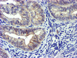 m05239 anti gsto2 mouse monoclonal antibody clone id oti2a12 ihc testing 4