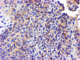 m05239 anti gsto2 mouse monoclonal antibody clone id oti2a12 ihc testing 5