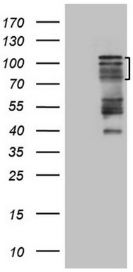 HEK293T cells were transfected with the pCMV6-ENTRY control (Left lane) or pCMV6-ENTRY HIPK1 (Right lane) cDNA for 48 hrs and lysed