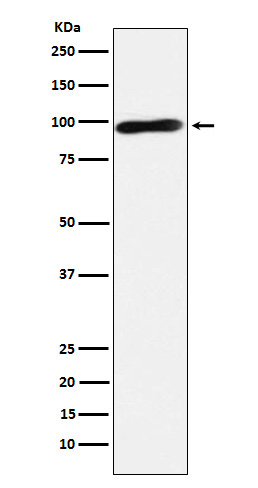 Western blot analysis of Calmegin expression in Jurkat cell lysate