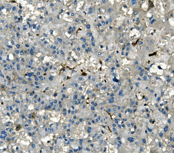 m05278 akr1d1 primary antibodies ihc testing 2