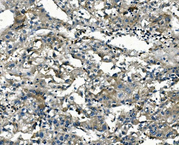 m05278 akr1d1 primary antibodies ihc testing 3