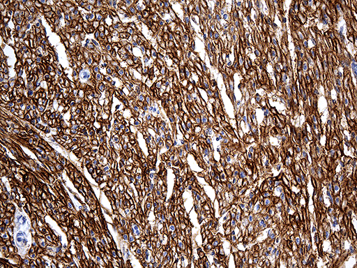 Immunohistochemical staining of paraffin-embedded Human adult heart tissue within the normal limits using anti-SGCD mouse monoclonal antibody