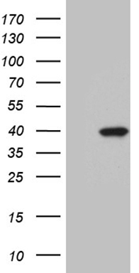 HEK293T cells were transfected with the pCMV6-ENTRY control (Left lane) or pCMV6-ENTRY SGCD (Right lane) cDNA for 48 hrs and lysed