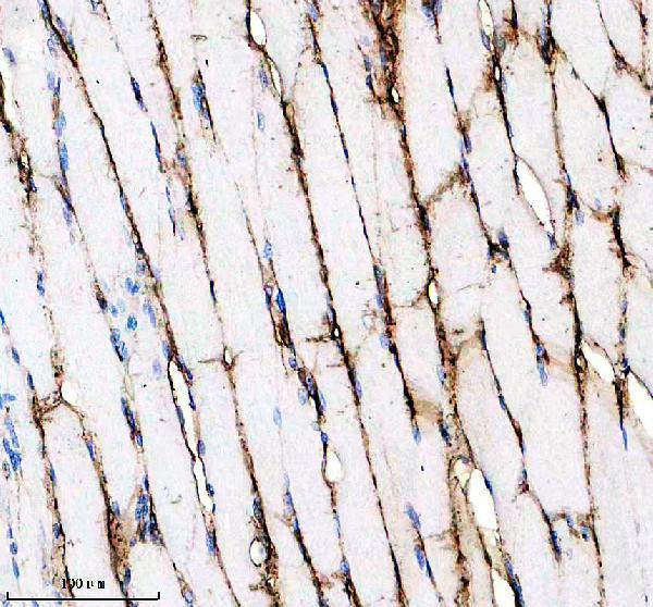 m05297 sgcd primary antibodies ihc testing 1