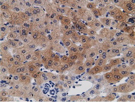 m05298 anti mu crystallin crym mouse monoclonal antibody clone id oti1g7 ihc testing 10
