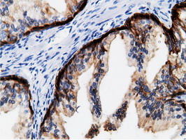 m05298 anti mu crystallin crym mouse monoclonal antibody clone id oti1g7 ihc testing 5
