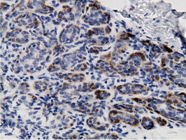 m05298 anti mu crystallin crym mouse monoclonal antibody clone id oti1g7 ihc testing 6