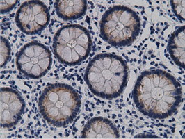 m05298 anti mu crystallin crym mouse monoclonal antibody clone id oti1g7 ihc testing 7