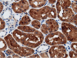 m05298 anti mu crystallin crym mouse monoclonal antibody clone id oti1g7 ihc testing 8