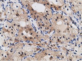 m05298 anti mu crystallin crym mouse monoclonal antibody clone id oti1g7 ihc testing 9