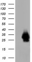 HEK293T cells were transfected with the pCMV6-ENTRY control (Left lane) or pCMV6-ENTRY CRYM (Right lane) cDNA for 48 hrs and lysed