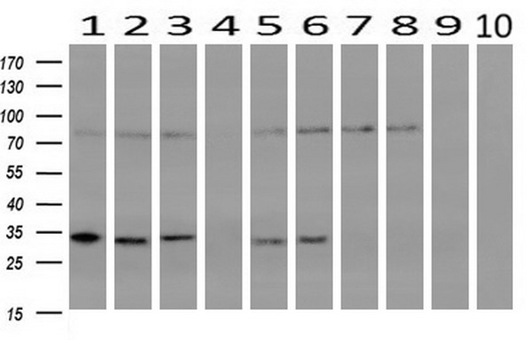 Western blot analysis of extracts (10ug) from 10 Human tissue by using anti-CRYM monoclonal antibody at 1:200 (1: Testis; 2: Omentum; 3: Uterus; 4: Breast; 5: Brain; 6: Liver; 7: Ovary; 8: Thyroid gland; 9: colon;10: spleen)