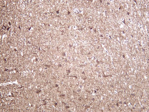 m05307 9 nefh primary antibodies ihc testing 2