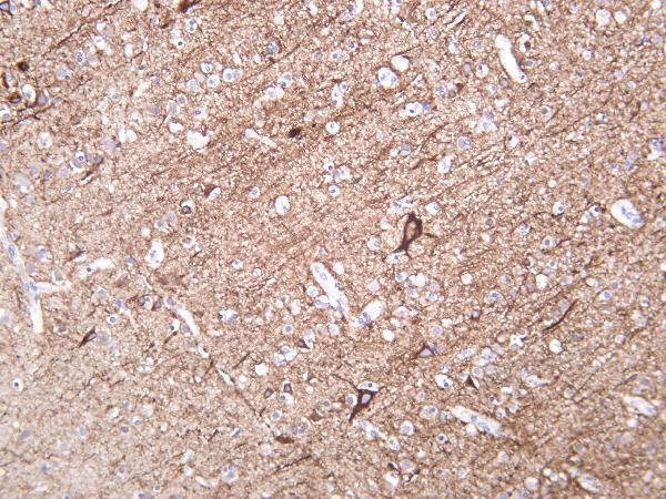 m05307 9 nefh primary antibodies ihc testing 3