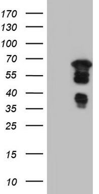 HEK293T cells were transfected with the pCMV6-ENTRY control (Left lane) or pCMV6-ENTRY DBNL (Right lane) cDNA for 48 hrs and lysed