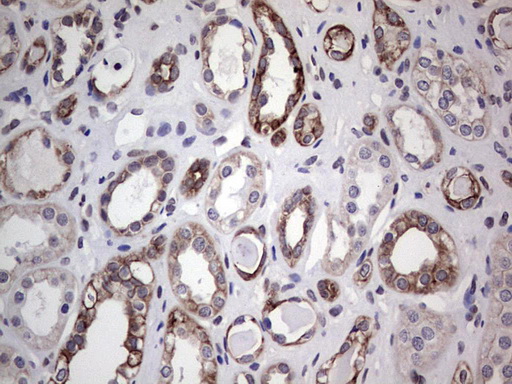 Immunohistochemical staining of paraffin-embedded Human Kidney tissue within the normal limits using anti-DBNL mouse monoclonal antibody