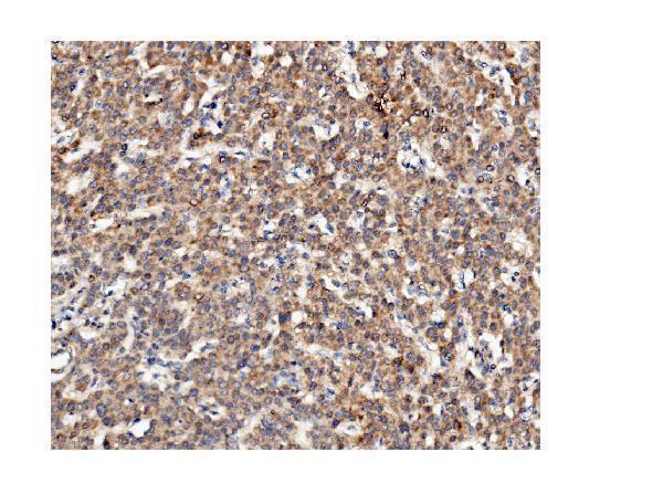 m05324 ckap5 primary antibody ihc testing 2