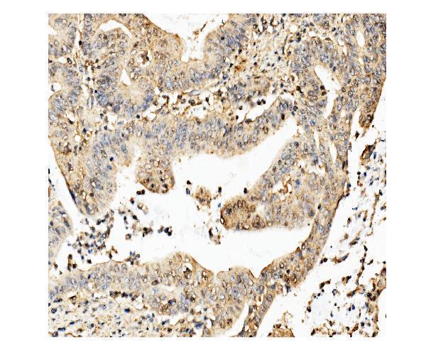 m05324 ckap5 primary antibody ihc testing 3