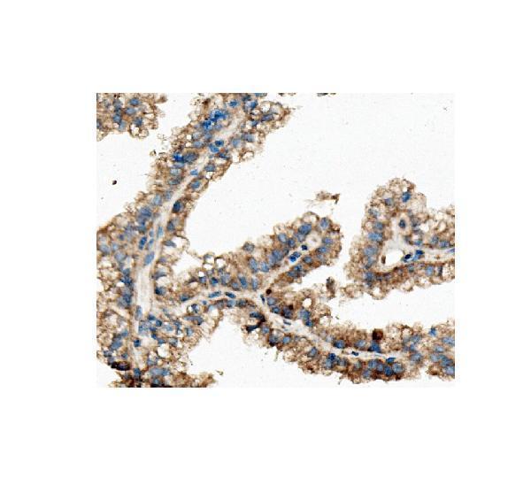 m05324 ckap5 primary antibody ihc testing 4