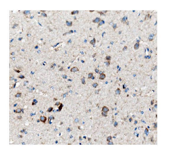 m05324 ckap5 primary antibody ihc testing 5