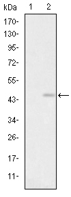 Immunohistochemistry analysis of paraffin-embedded human brain tissues (left) and rat brain tissues (right) with DAB staining using GluR-3 Monoclonal Antibody