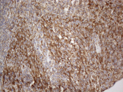 m05329 anti vapa mouse monoclonal antibody clone id oti10e10 ihc testing 11