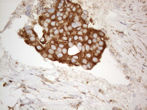 m05329 anti vapa mouse monoclonal antibody clone id oti10e10 ihc testing 12